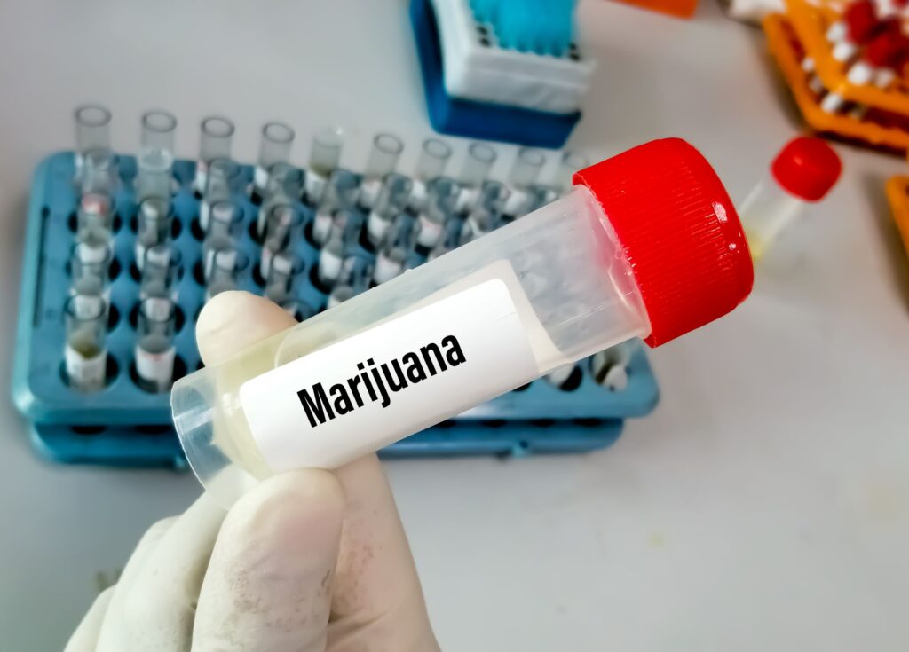 marijuana drug test in the lab