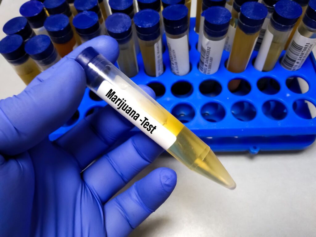 Will Using Medical Cannabis Cause Issues With My Employer